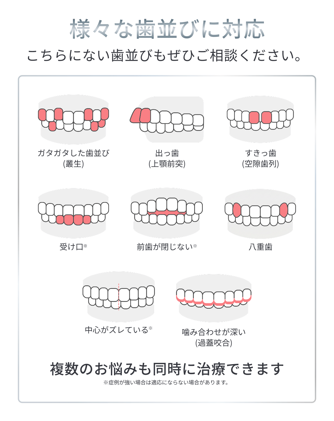 さまざまな歯並びに対応