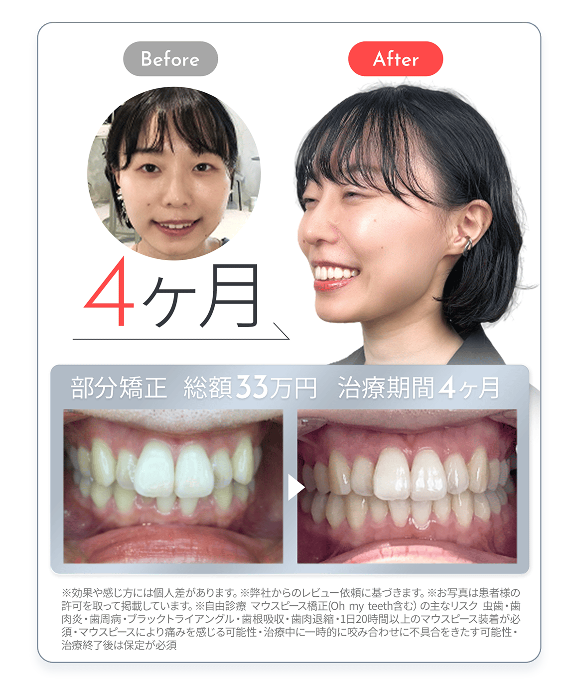 症例1