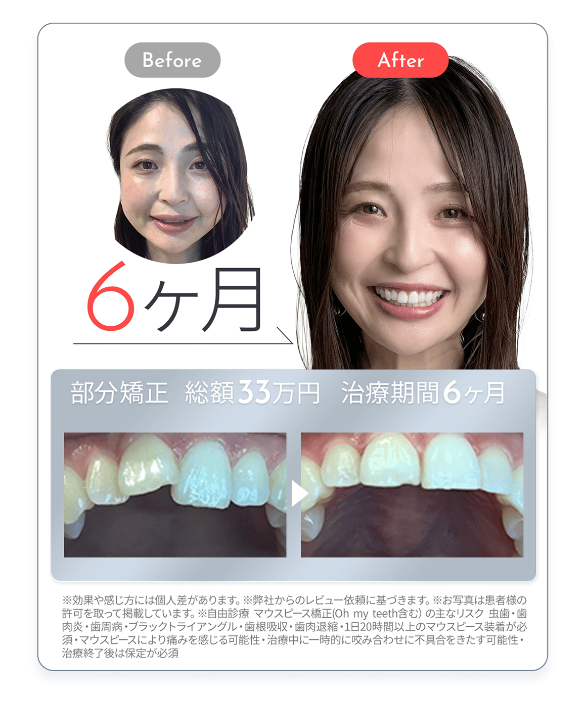 症例2
