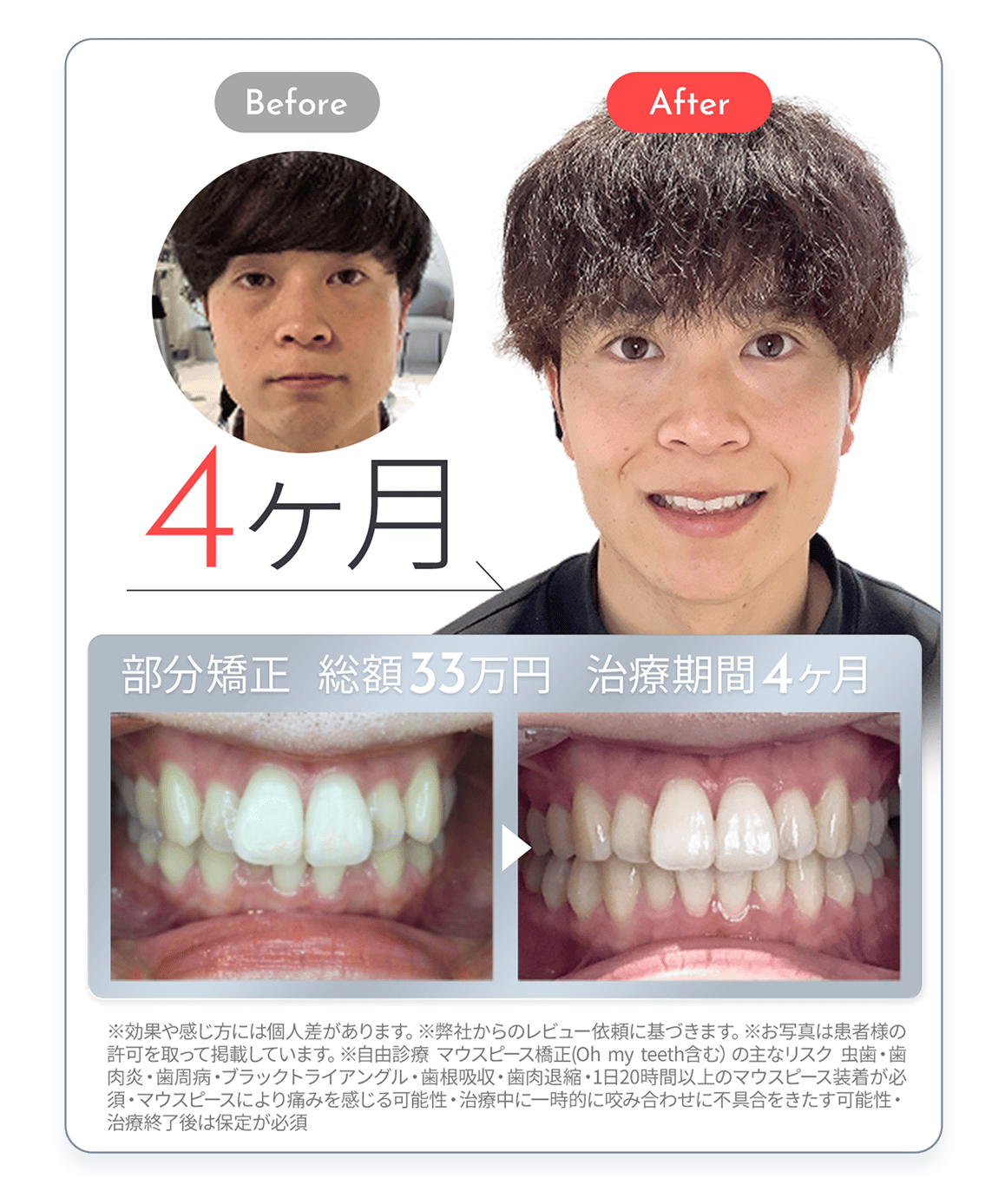 症例3